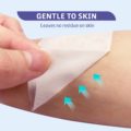 Conkote surgical tape