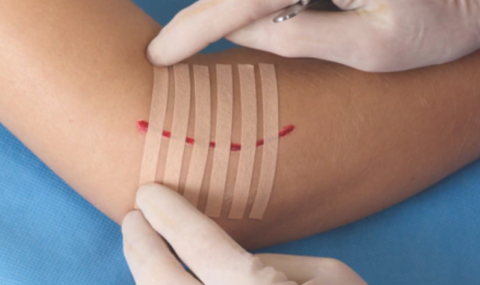 How to Choose the Best Medical Tape for Wound Care