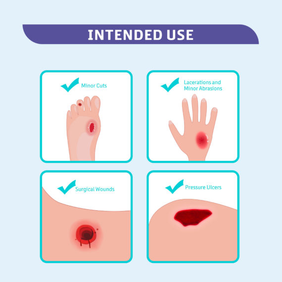 Calcium Alginate Wound Dressing