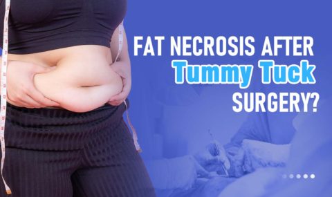 Tummy Tuck Banner