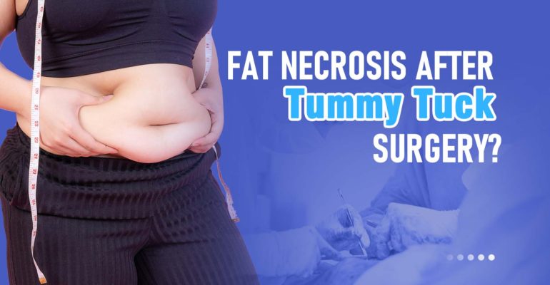 Tummy Tuck Banner