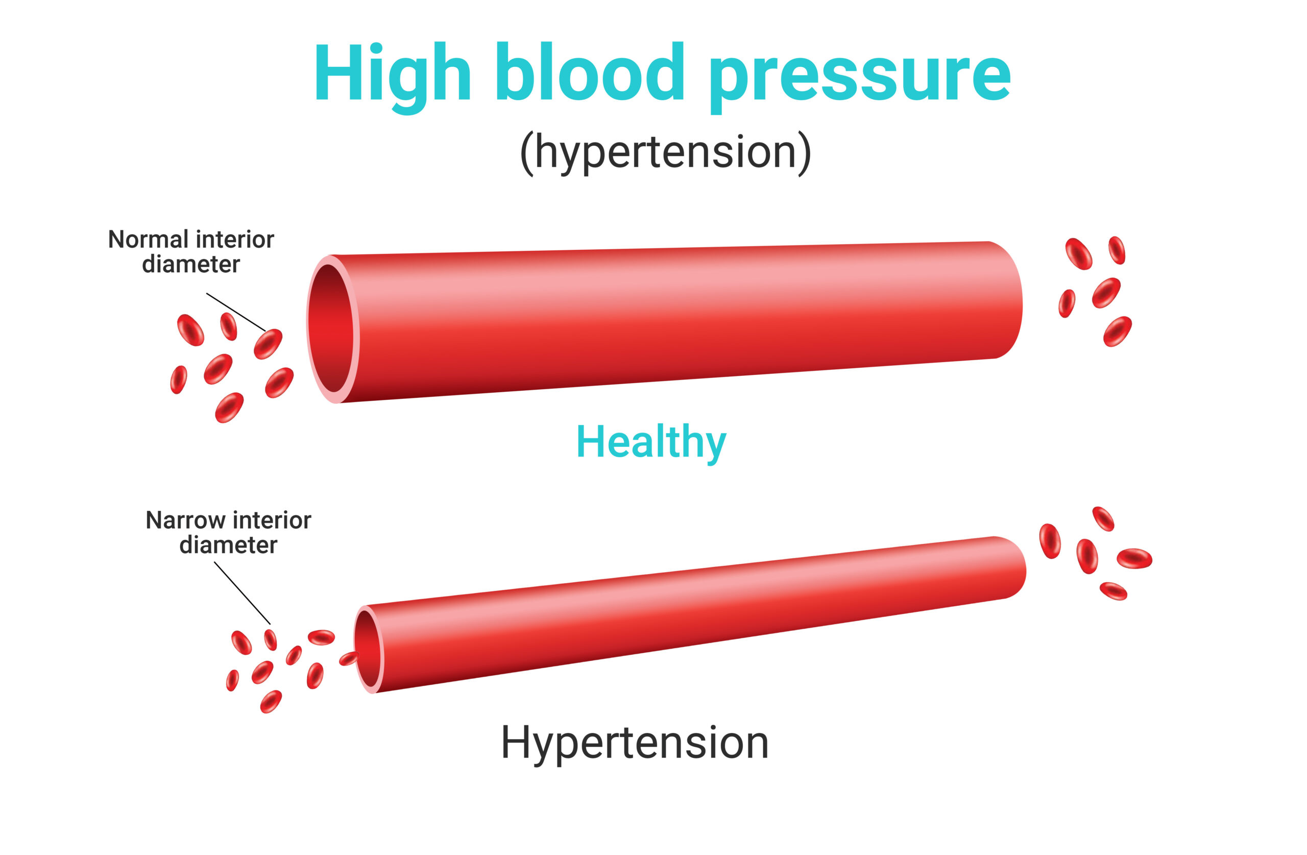 Healthy Hypertension