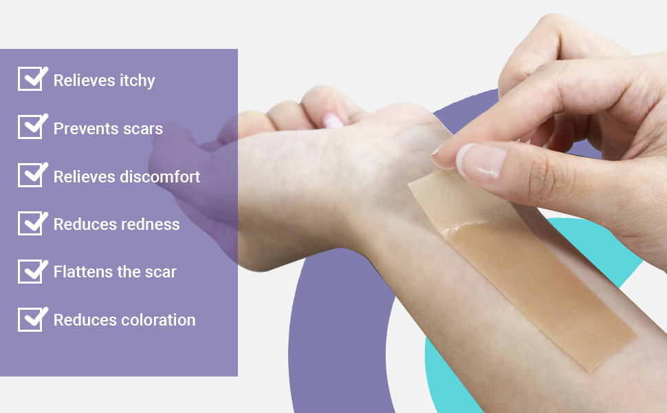 Conkote Silicone Scar Sheet