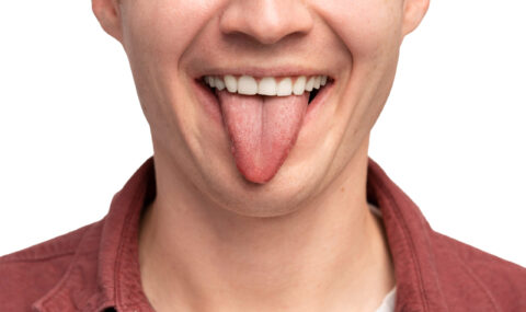 What Color Is Your Tongue? What is healthy?