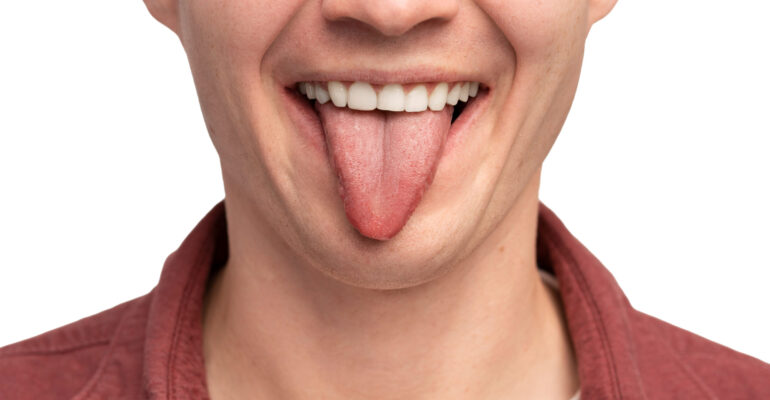 What Color Is Your Tongue? What is healthy?