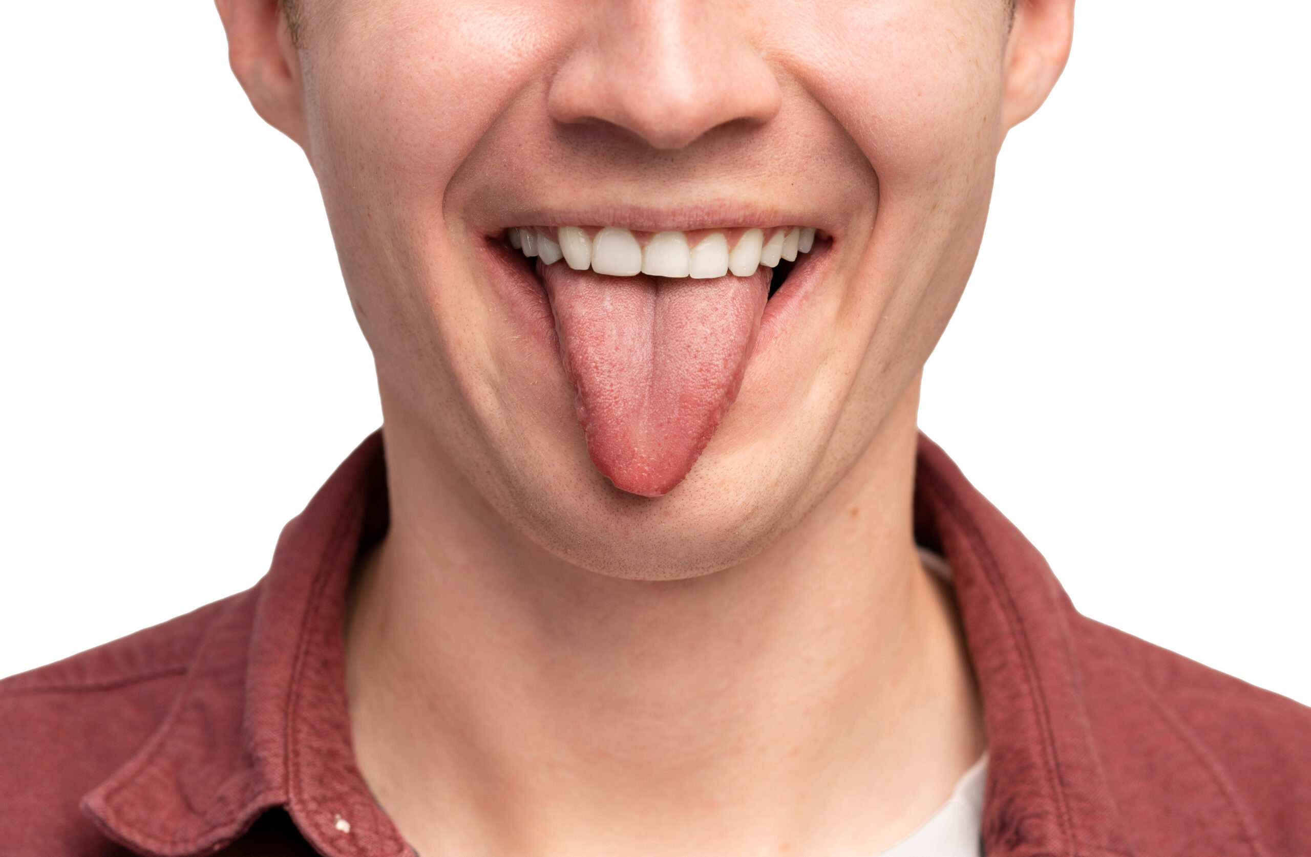 What Color Is Your Tongue? What is healthy?