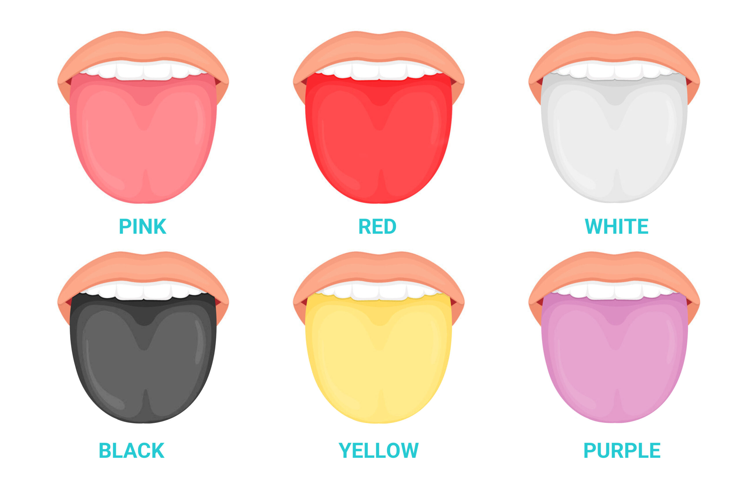 Tongue Colors and What They Indicate